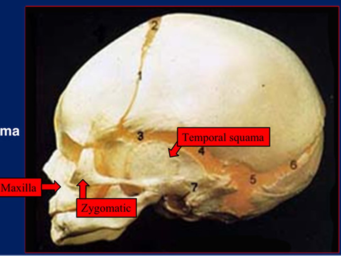 <p>The membranous viscerocranium is comprised of</p>