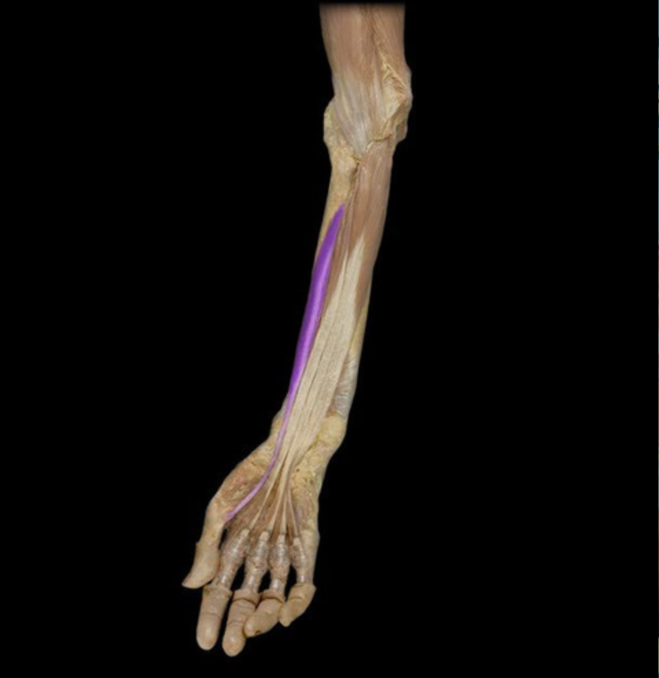 <p><em>table 1, median n (C8-T1), thumb IP joint flexion</em></p>