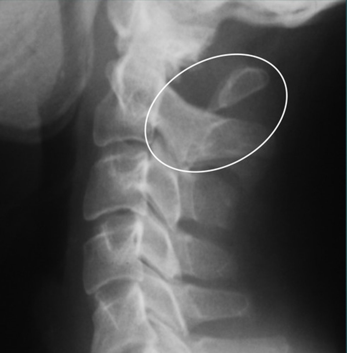 <p>What anomaly is this?</p>