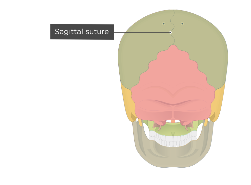 <p>[BONES TO KNOW; suture] the midline of the skull, separating the <u>parietal bone</u> into two halves.</p>