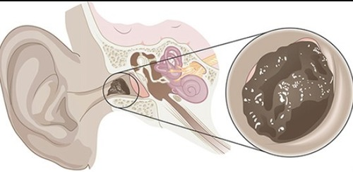 <p>What is the condition or diagnosis called?</p>