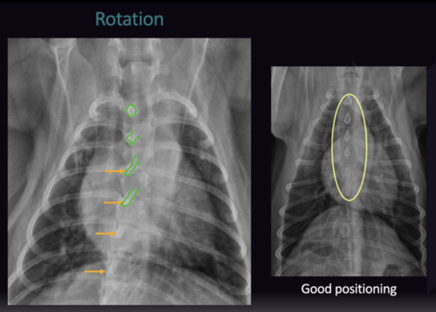<p>Spinous processes Are in the centre of the vertebrae</p>