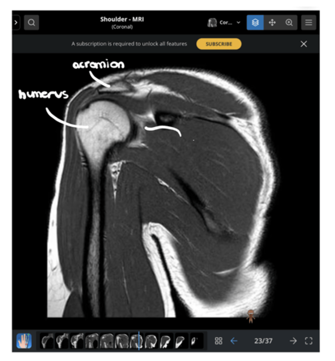 <p>1. What view is this image?</p><p>2. Which structure is being pointed to?</p>