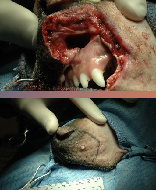 <p>treat the tumor as if it were an abscess and the tumor cells are bacteria--> potential to seed anywhere in the tissue once you've exposed your instruments/gloves to them</p>