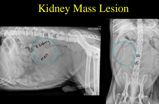 <p>Kidney diseases  on Radiographs </p>