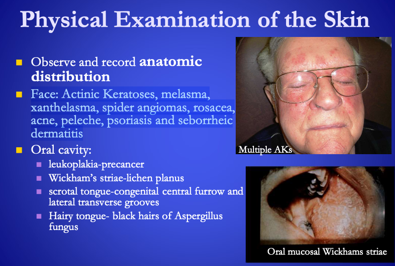 <p><span><strong>[where would you find the following?]</strong></span>:&nbsp;</p><ul><li><p>leukoplakia - precancer</p></li><li><p>Wickham’s striae-lichen planus</p></li><li><p>scrotal tongue - congenital central furrow and lateral transverse grooves</p></li><li><p>Hairy tongue - black hairs of Aspergillus fungus&nbsp;</p></li></ul><p></p>