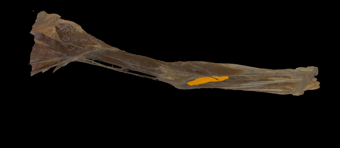 term image
