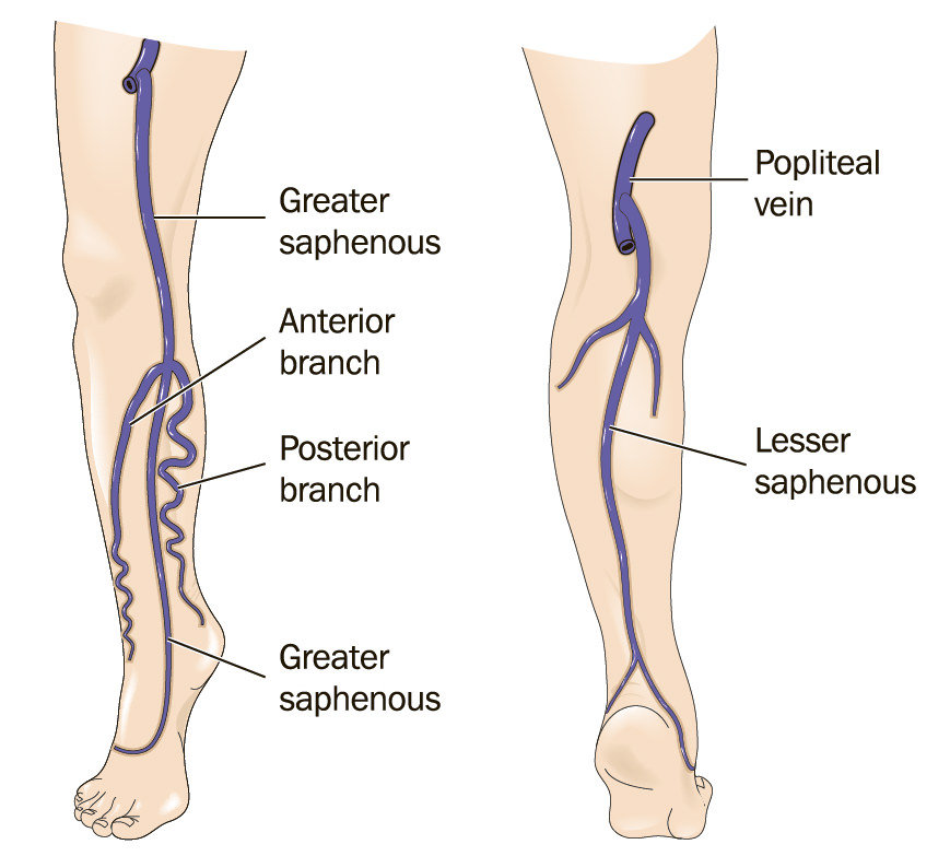 <p>in the medial lower limb</p>