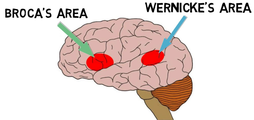 posterior 1/3 portion of the left superior temporal gyrus
