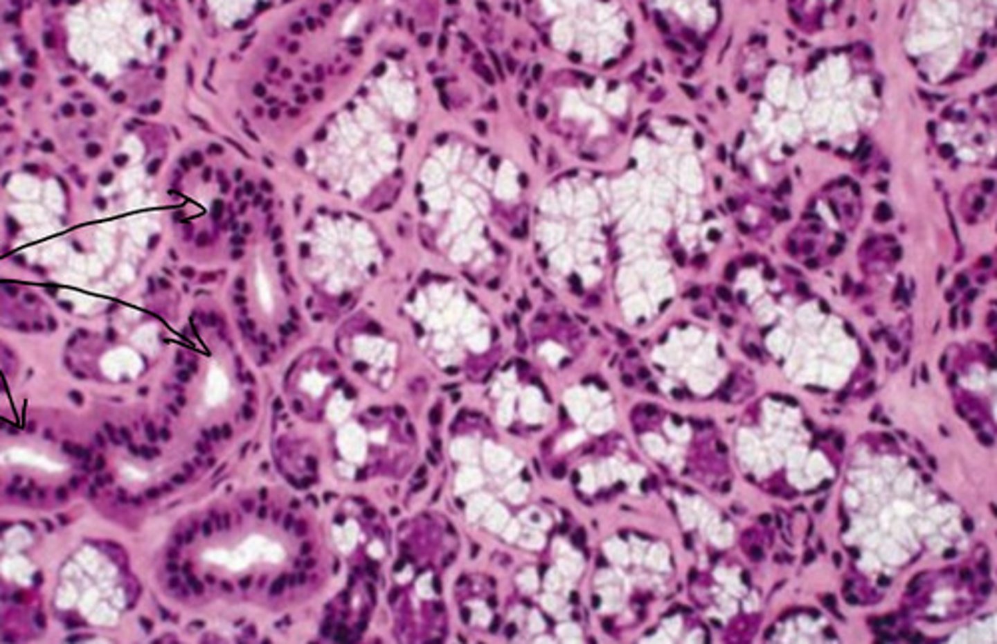 <p>ID the Histology</p>