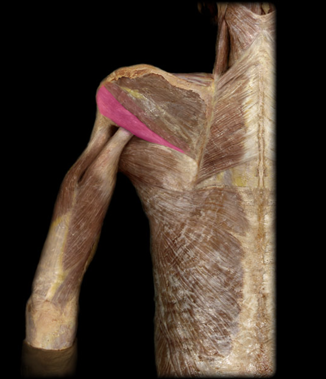 <p>Teres minor m. (innervation)</p>