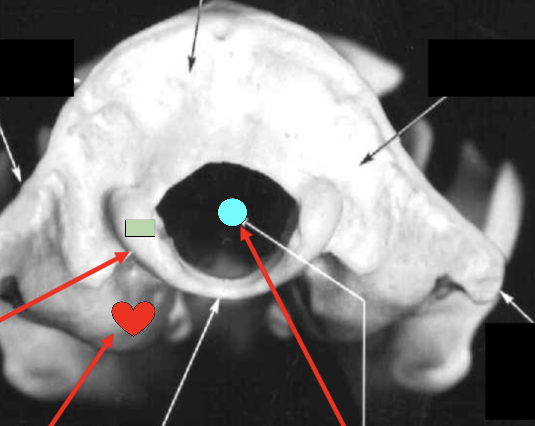 <p>Which bone segment is represented by the heart?</p>