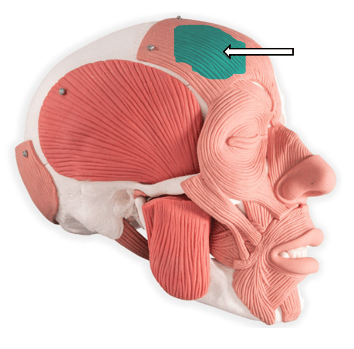 <p>name the muscle</p>