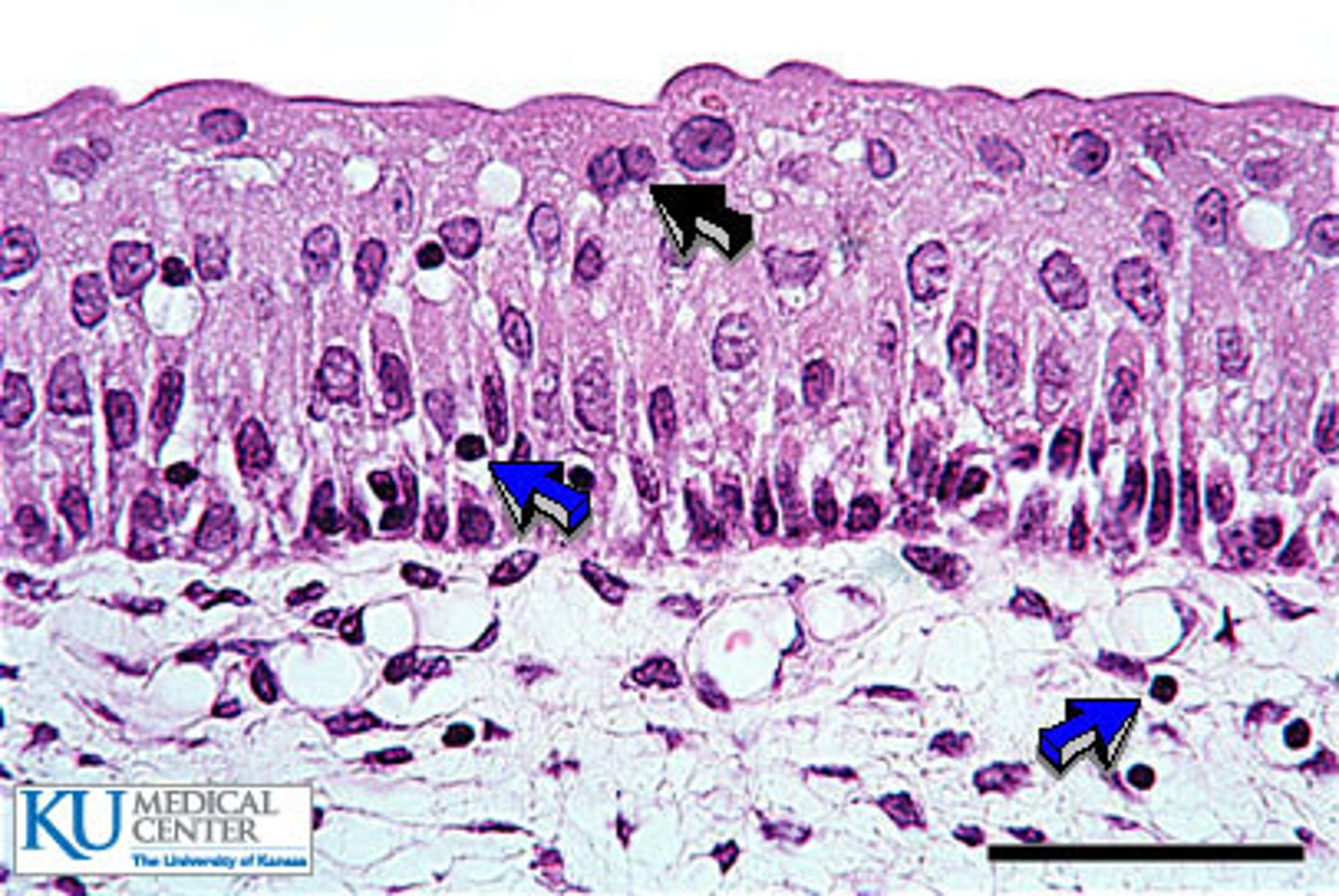 <p>Function - Stretches readily and permits distension of urinary organ by contained urine.</p><p>Location - Lines the ureters, urinary bladder, and part of urethra.</p>