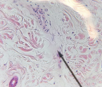 <p>what kind of tissue is this</p>