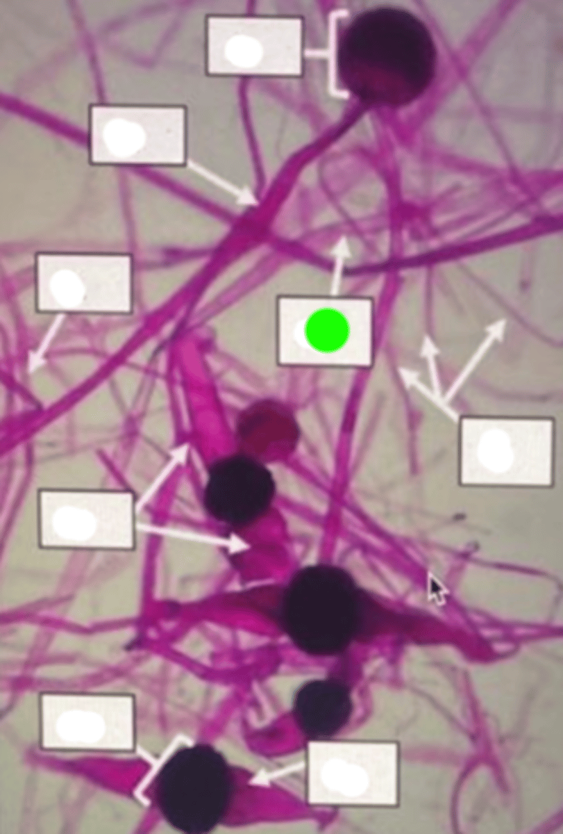 <p>Thread-like filaments constituting the vegetative body of the fungus, responsible for nutrient absorption, growth, and expansion.</p>