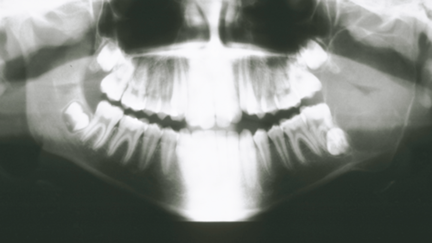 <p>What category would this lesion be part of?</p>
