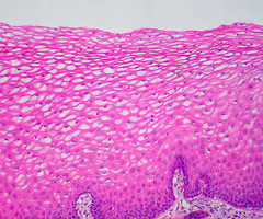 <p>type of epithelium lining oropharynx </p>