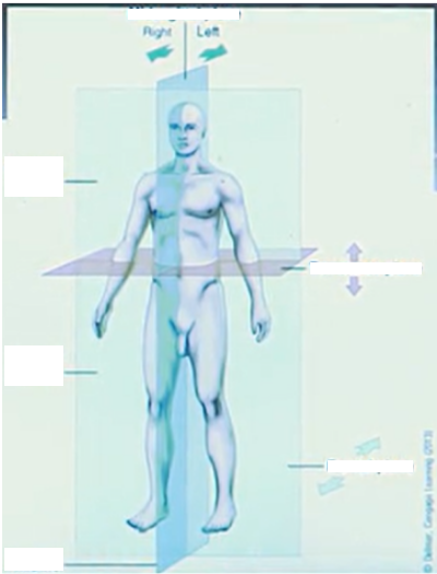 <p>Label correctly</p>