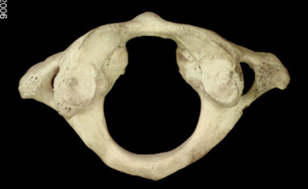 <p>What is this bone?</p>