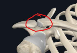 <p>What is this joint called?</p>