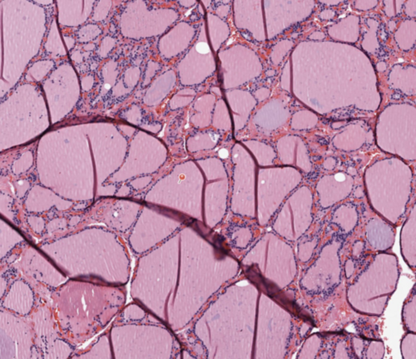 <p>Thyroid</p>