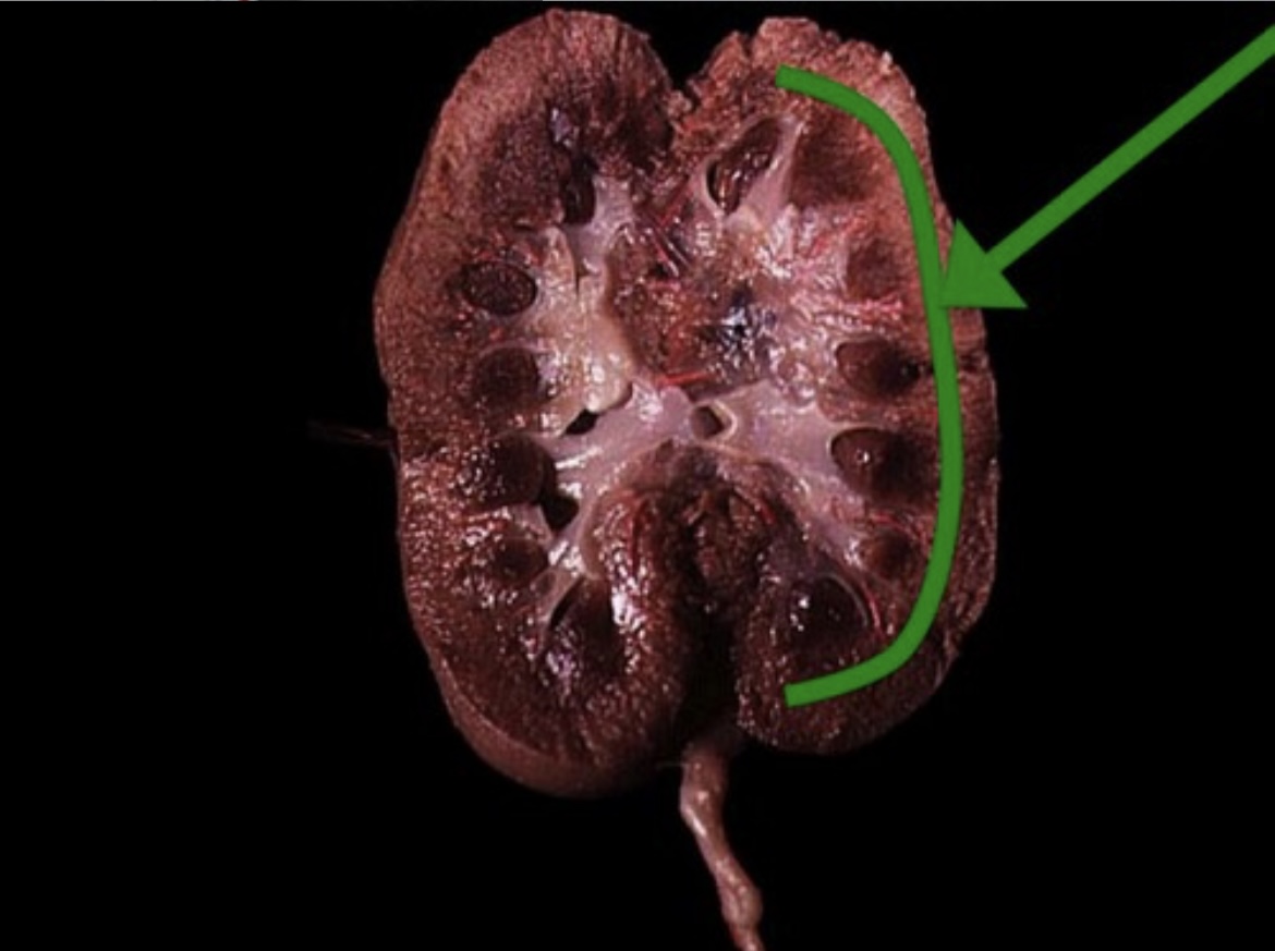 <p>Outer region of the kidney containing nephrons’ glomeruli.</p>
