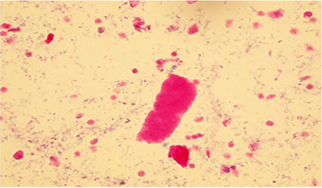 <p>what do waxy casts represent?</p><p>how are they identified</p>