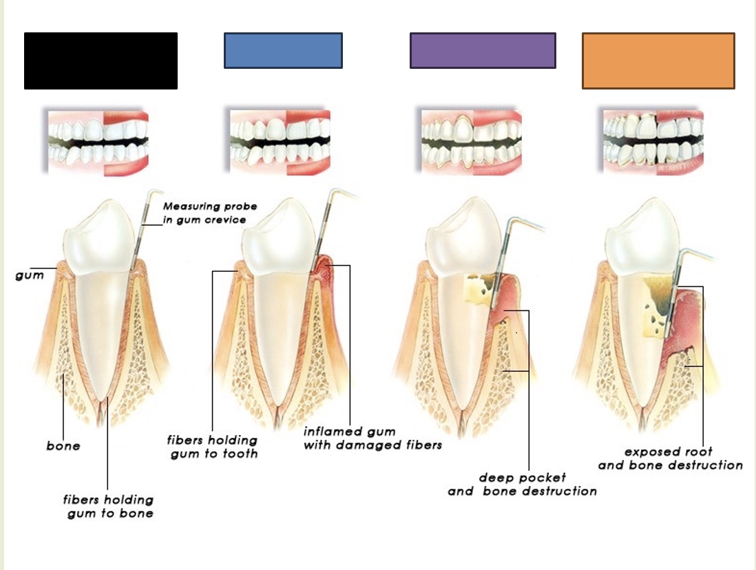 <p>What is indicated by the black box?</p>