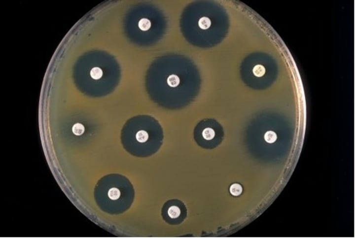 <p>The test to determine the efficacy of antibiotics or the antibiotic resistance of bacteria. Zone of Inhibition</p>