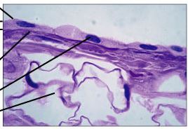 <p>single layer of thin and flattened cells; found in air sacs in lungs, lining of blood vessels</p>