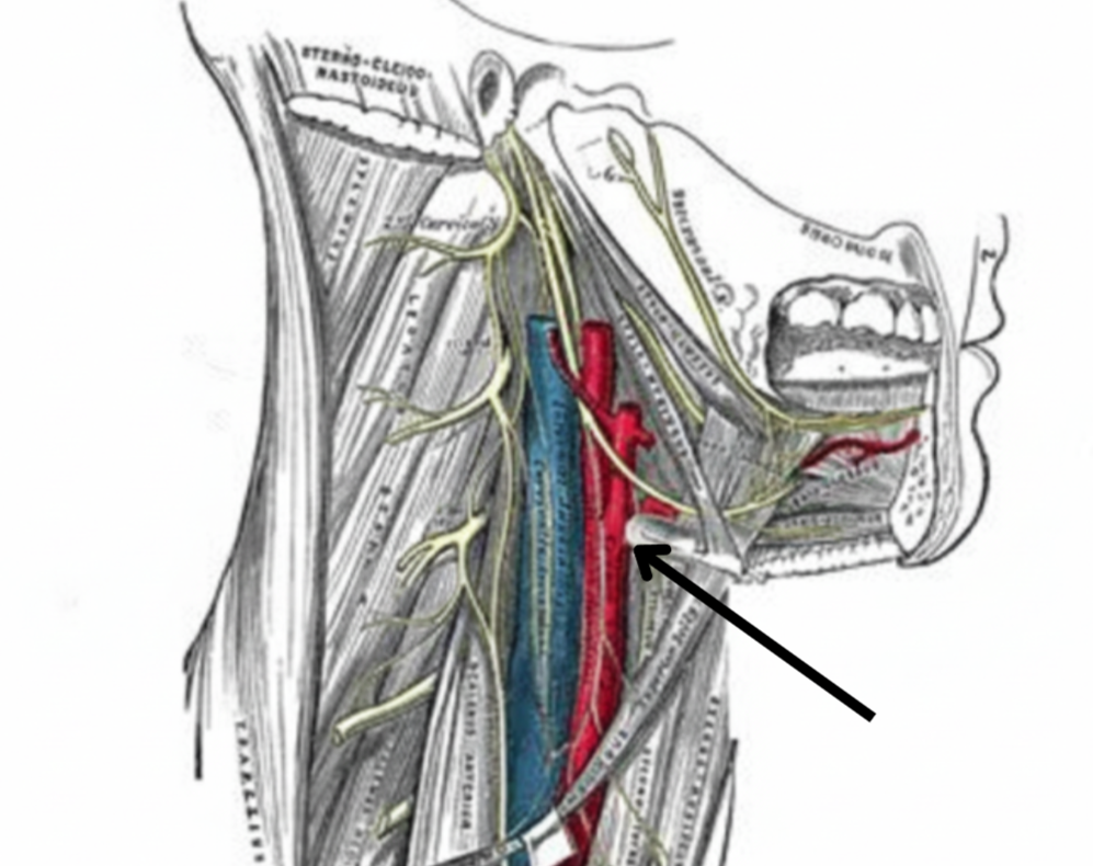 term image