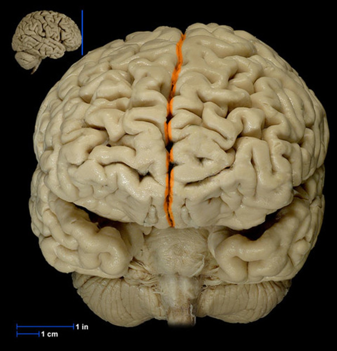 <p>invisible gap down the middle of th ebrain</p>