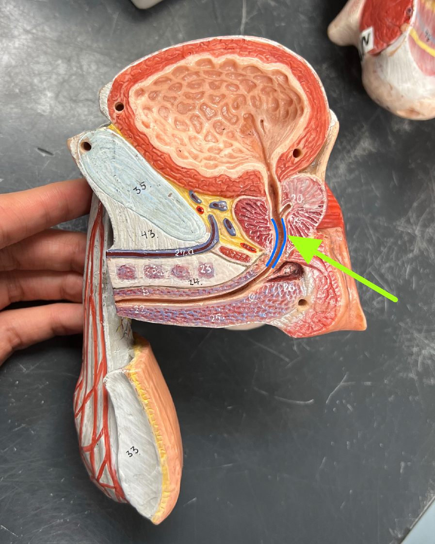 what is this?