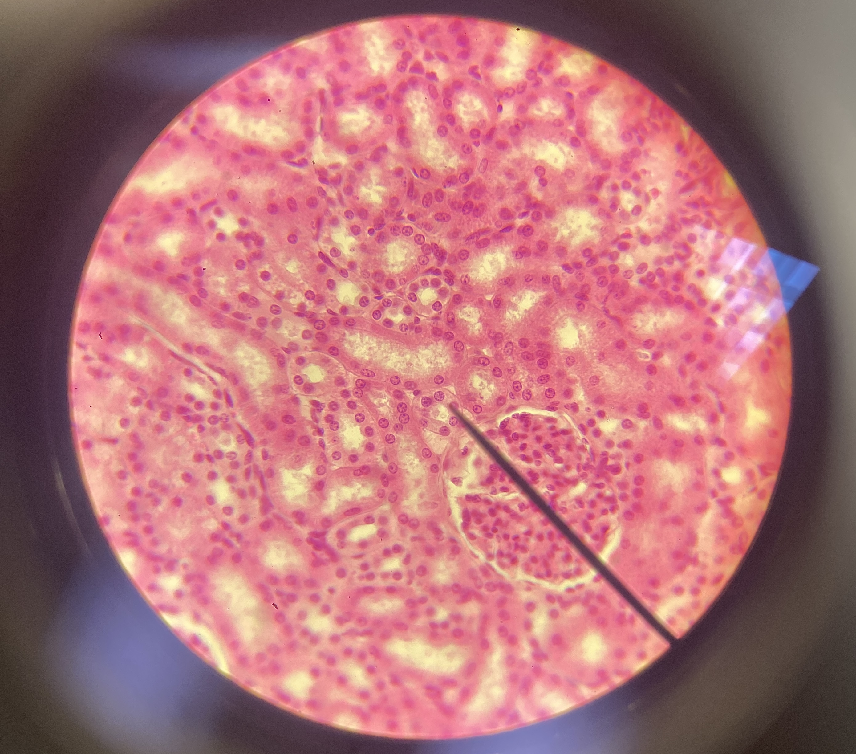 <p>simple cuboidal epithelium</p>