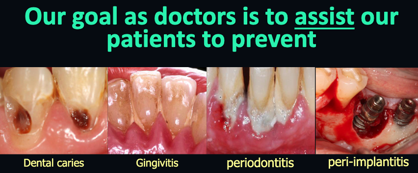 <p>biofilm attached to the tooth/implant</p>