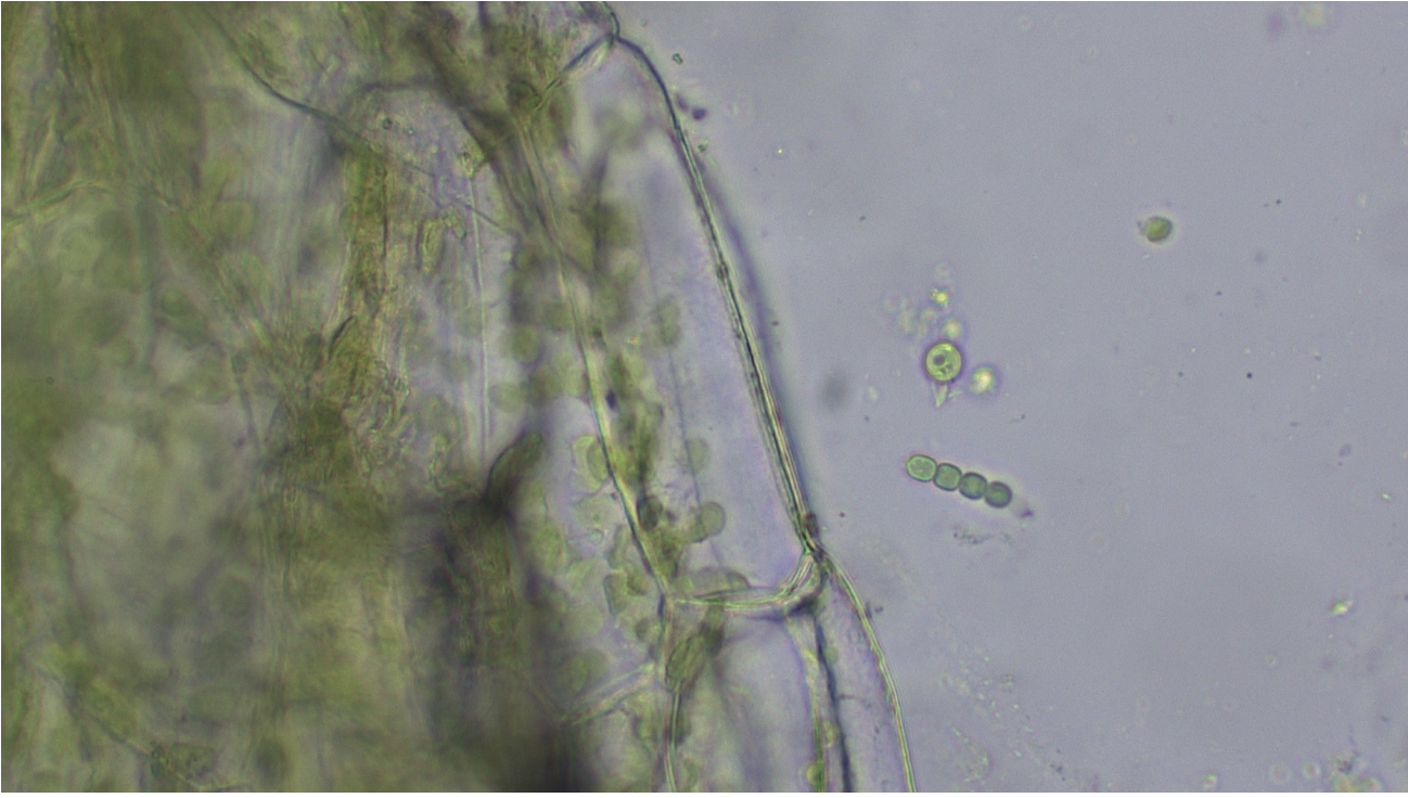 <p>symbiotic mutualistic relationship</p><p>One is a plant, photosynthetic other is a bacteria also photosynthetic</p><p><strong>(Plant) provides an enclosed environment for (bacteria) within its leaves</strong>. In return, (bacteria) sequesters nitrogen directly from the atmosphere which then becomes available for (plants)'s growth, freeing it from the soil that is needed by most other land plants for their nitrogen fertilization.</p>