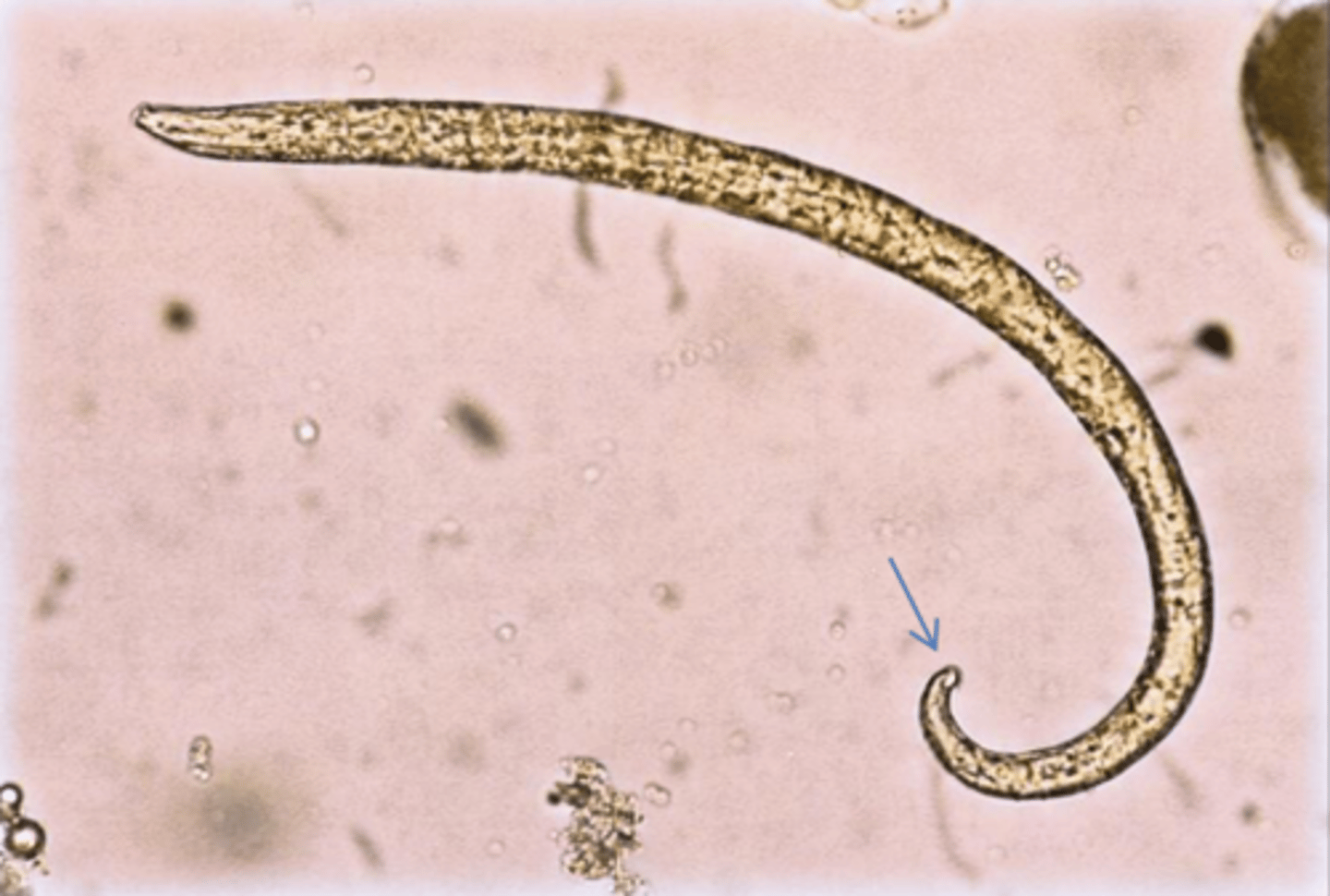 <p>Found in outdoor-reared pigs presenting with cough. What parasite is this?</p>