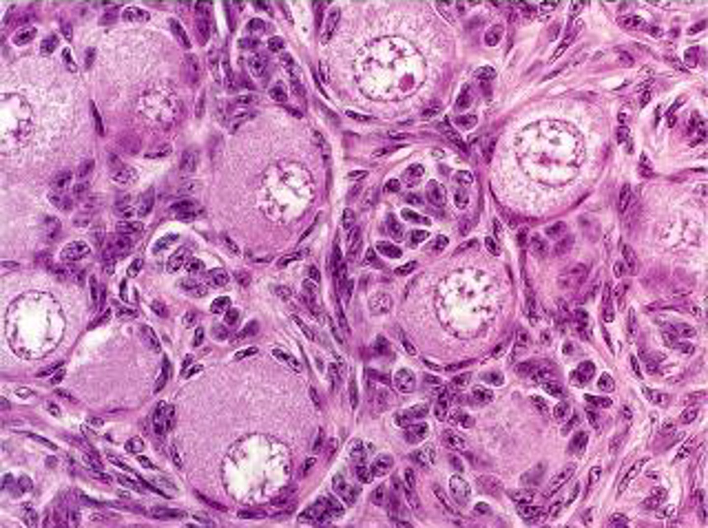 <p>(adj.) developed or created at the very beginning; going back to the most ancient times or earliest stage; fundamental, basic</p><p>SYN: original, primal</p>