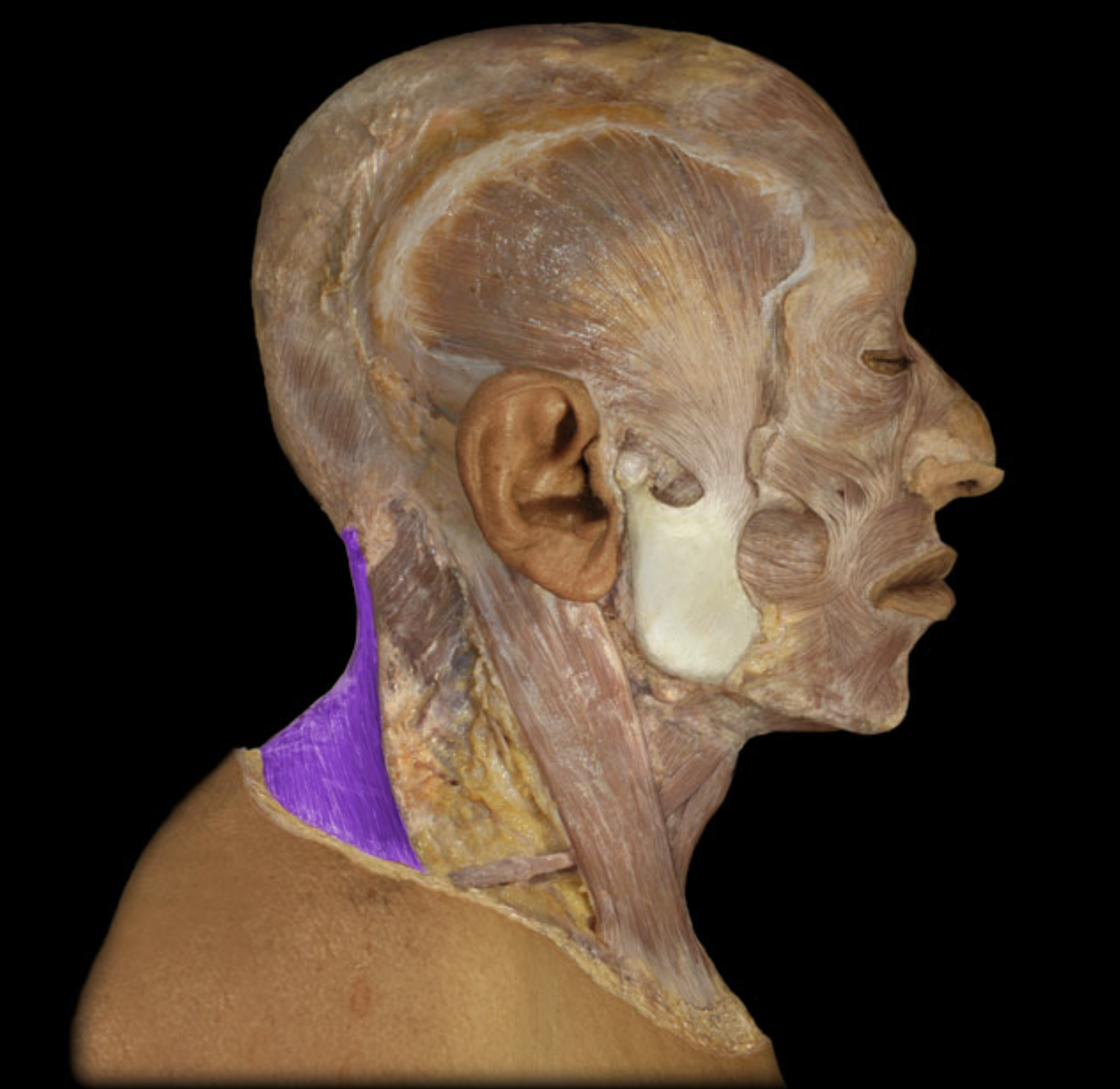 <p>What muscle is this?</p>