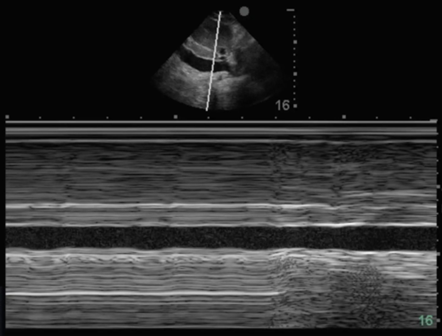 <p>which imaging mode is illustrated below?</p>