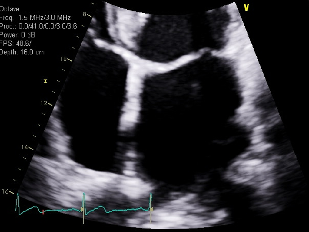 <p>Obtain zoomed LA view 2D</p>