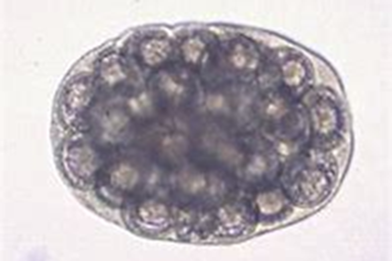 Host: dogs and cats
Intermediate host: adult fleas
Location: small intestine
Transmission: ingestion of infective adult flea
Diagnosis: fecal float, presence of proglottids in stool
Treatment: praziquantel or epsiprantel and flea control
Zoonotic?: yes
Common name: cucumber seed tapeworm
key fact: found in feces, hair, or bedding, commonly mistaken as uncooked rice