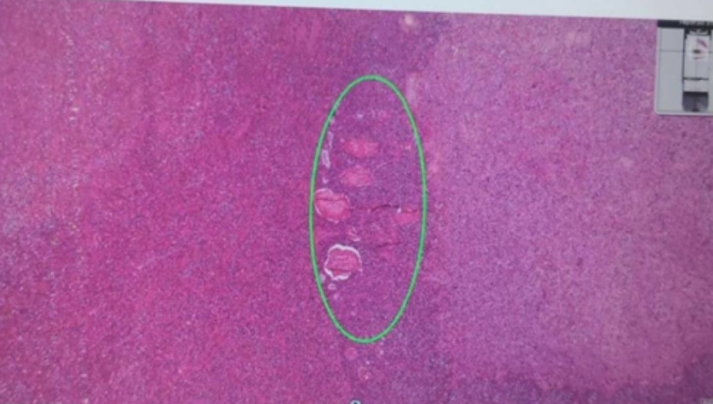 <p>Name the part circled in green:</p><p>a) Adenohypophysis</p><p>b) Neurohypophysis</p><p>c) Pars intermedia</p><p>d) Pars tuberalis</p>