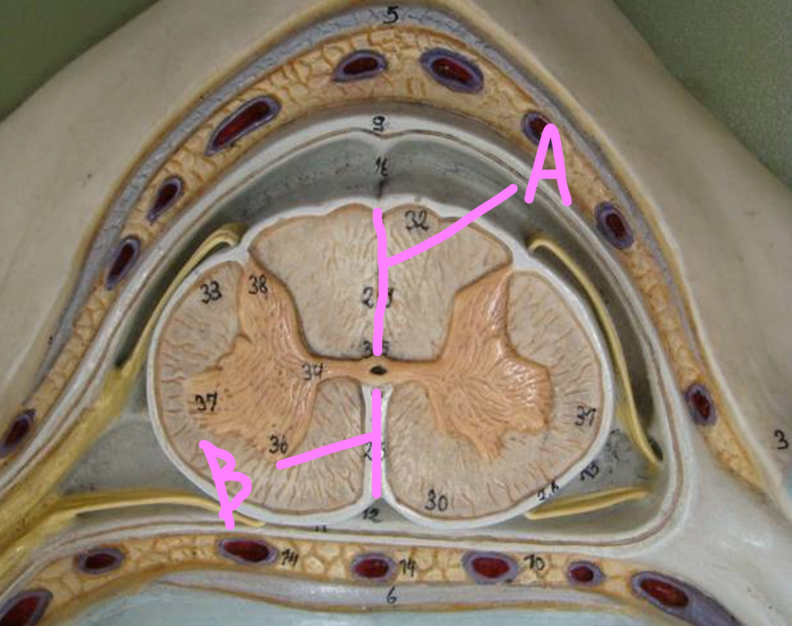 <p>What is A?</p>