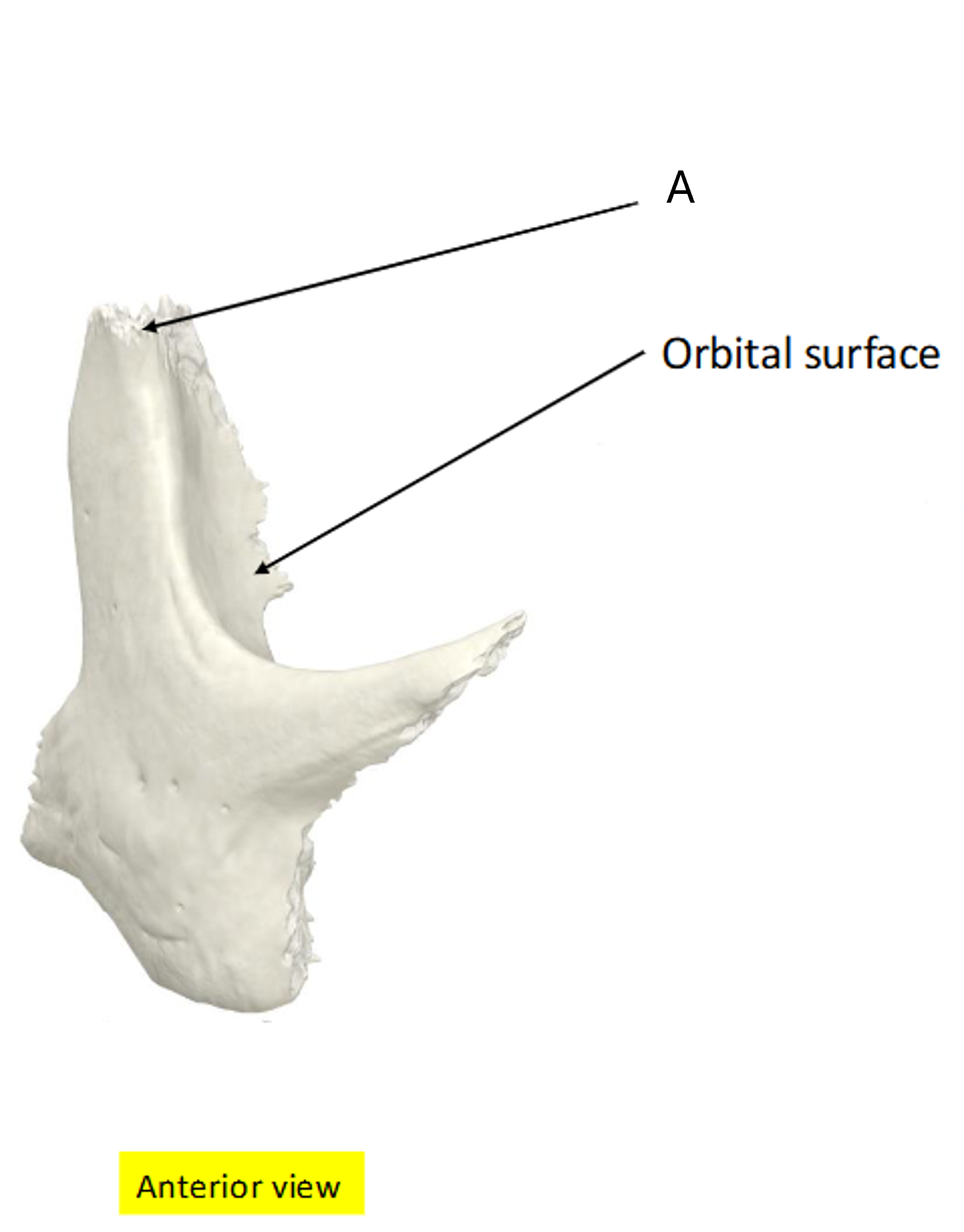 term image