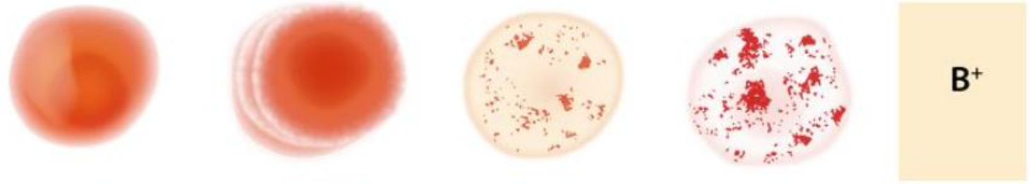* antibody B and antigen B that cause clumping
* antibody D that cause clumping (+)