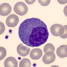 <ul><li><p><mark data-color="#00e0f7" style="background-color: rgb(0, 224, 247); color: inherit;">MAKE ANTIBODIES AFTER ACTIVATION</mark></p></li><li><p>Fully differentiated antibody-secreting factories derived from B cells</p></li><li><p>Reside in bone marrow or peripheral lymphoid tissues</p></li><li><p>Produces large volumes of antibodies specific to the antigen that stimulated the parent B cell</p></li><li><p>Extensive Rough ER (for antibody synthesis) and DO NOT typically circulate</p></li><li><p>Responsible for humoral immunity (e.g. plasma cells secreting IgA in mucosa, IgG in serum, etc.)</p></li></ul><p></p>