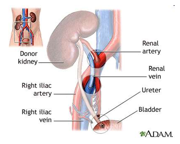 <ul><li><p><span><span>common iliac artery + vein</span></span></p></li><li><p><span><span>external iliac artery + vein</span></span></p></li><li><p><span><span>internal iliac artery + vein</span></span></p></li><li><p><span><span>ureter: neoimplantation or end-to-end anastomoses</span></span></p></li></ul><p></p>