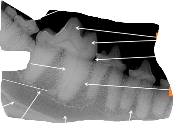 <p>Normal Dental Radiography - arrows meaning?</p>